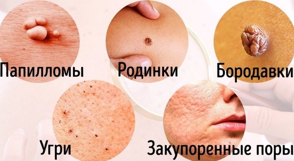8 захворювань, про наявність яких нам підкаже шкіра(відео)