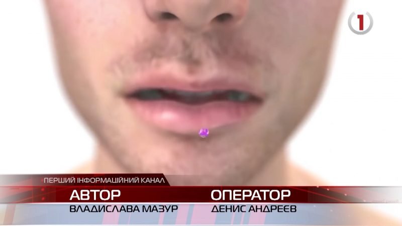 Туберкульоз на Закарпатті: статистика, профілактика, лікування (ВІДЕО)