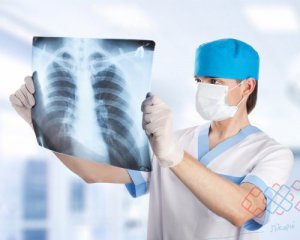 Дослідники онкології встановили причину появи раку