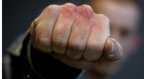 На Закарпатті жорстоко побили чоловіка