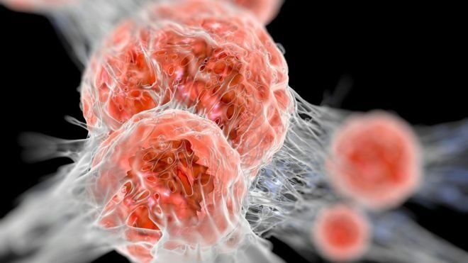 Нобель за імунотерапію раку: що це означає