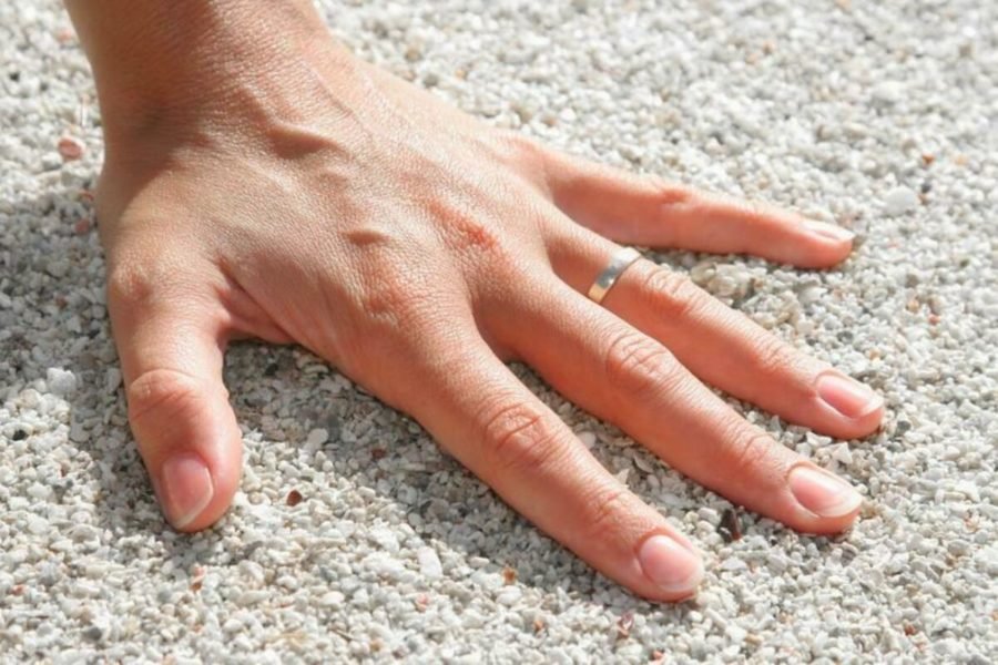 Вчені: Каблучки на пальцях можуть впливати на здоров’я людини