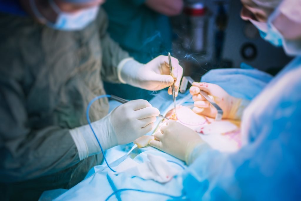 В Україні можуть дозволити трансплантацію: як це вплине на тисячі життів